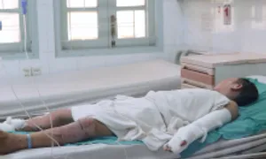 Chế pháo nổ, bé trai bỏng cháy cơ thể