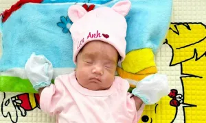 Nuôi sống bé sinh non nặng 850 gram